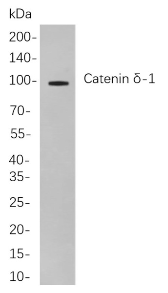 Recombinant Catenin δ-1 Monoclonal Antibody (AN300906L)
