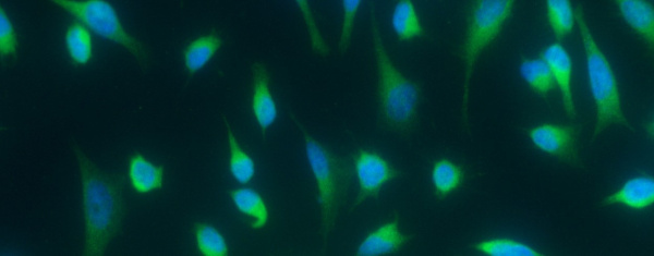 Recombinant CD208/DC-LAMP/LAMP3 Monoclonal Antibody (AN300098P)