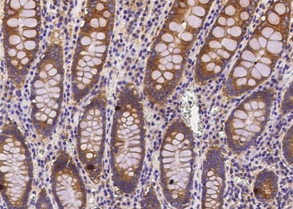Recombinant COMMD9 Monoclonal Antibody (AN300280P)