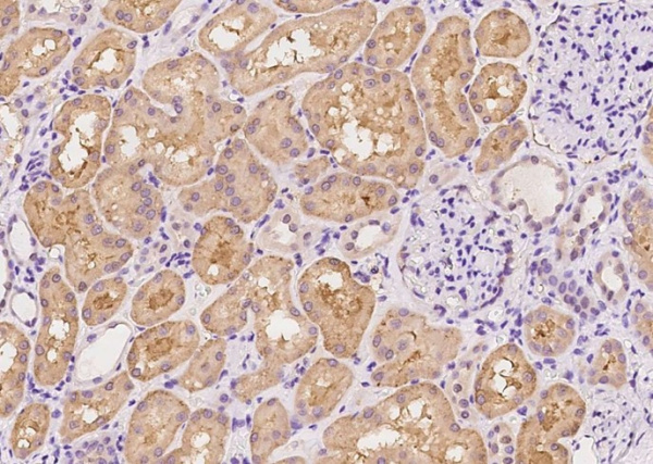 Recombinant Syndecan-1/SDC1 Monoclonal Antibody (AN300400P)