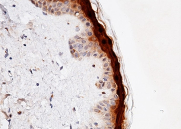 Recombinant CALML5 Monoclonal Antibody (AN300241P)