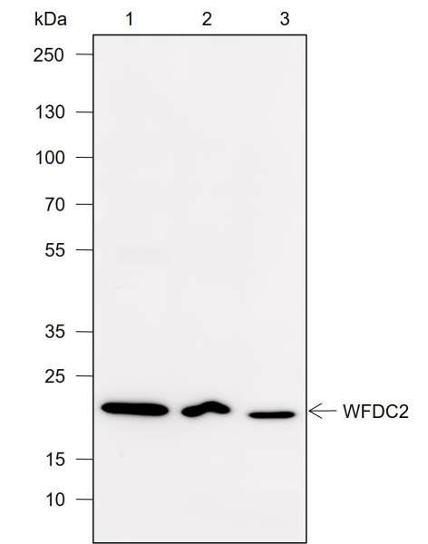 Recombinant WFDC2 Monoclonal Antibody (AN302016L)