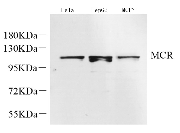 Mineralocorticoid receptor Polyclonal Antibody (E-AB-70260)
