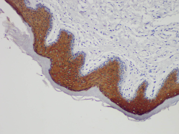 CK10 Monoclonal Antibody (ELAB6622-M)