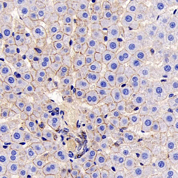 E-Cadherin Monoclonal Antibody (E-AB-70249)