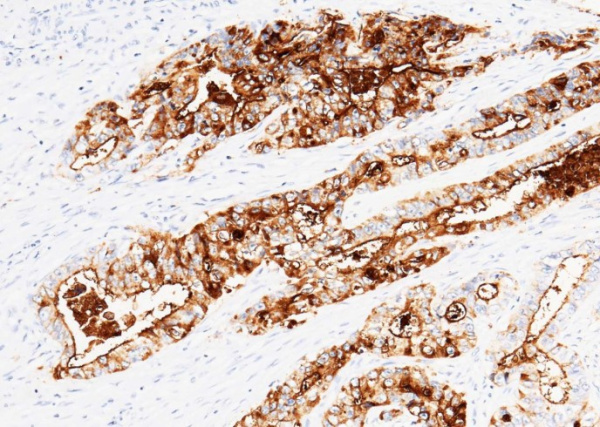 Recombinant CEACAM5/CD66e Monoclonal Antibody (AN300374P)