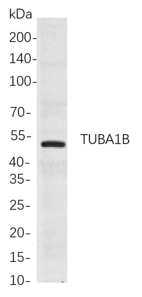 Recombinant TUBA1B Monoclonal Antibody (AN300966L)