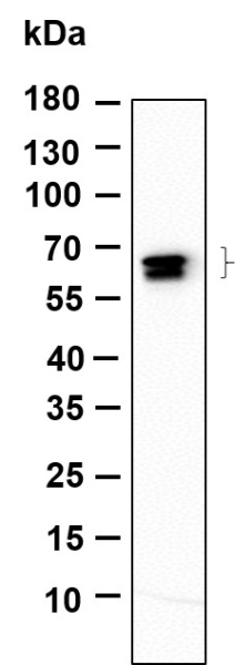 Recombinant GAD-65/67 Monoclonal Antibody (AN301129L)