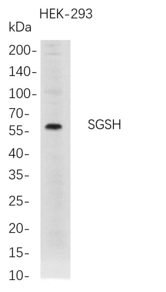 Recombinant SGSH Monoclonal Antibody (AN300786L)