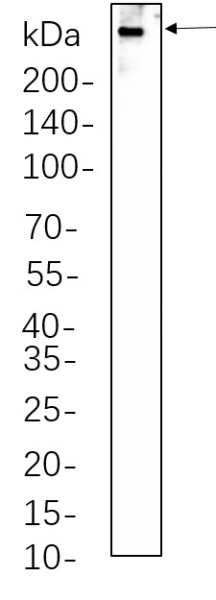 Recombinant Dystrophin Monoclonal Antibody (AN301304L)