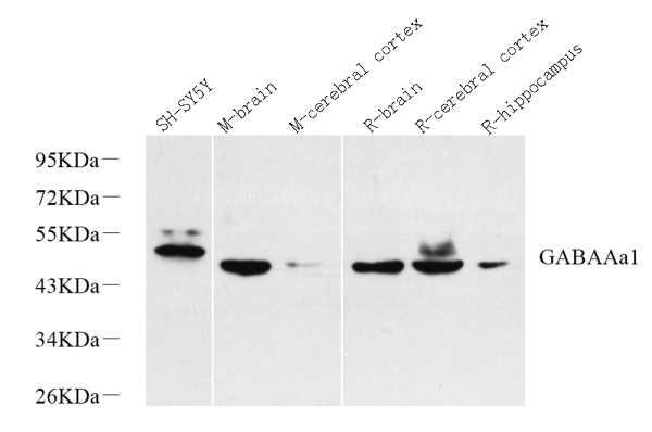 GABAA Receptor alpha1 Polyclonal Antibody (E-AB-70290)