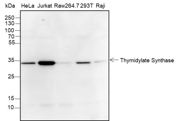 Recombinant Thymidylate Synthase Monoclonal Antibody (AN301674L)
