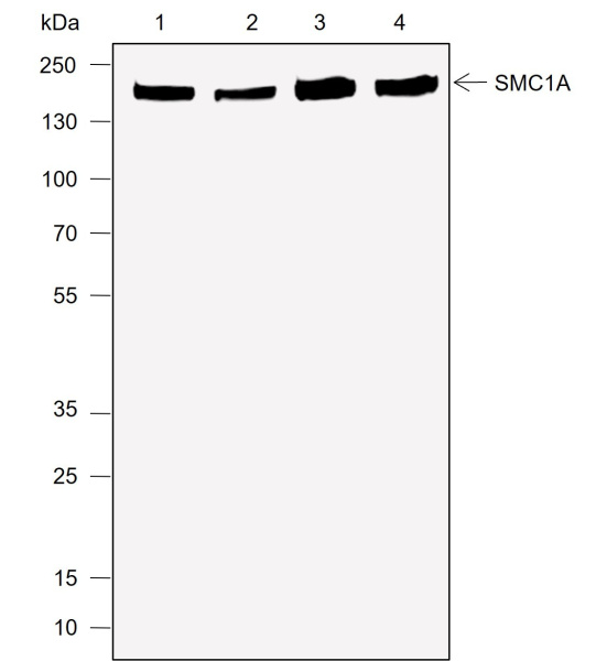 Recombinant SMC1A Monoclonal Antibody (AN301986L)