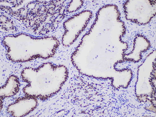 NKX3.1 Monoclonal Antibody (ELAB6859-M)