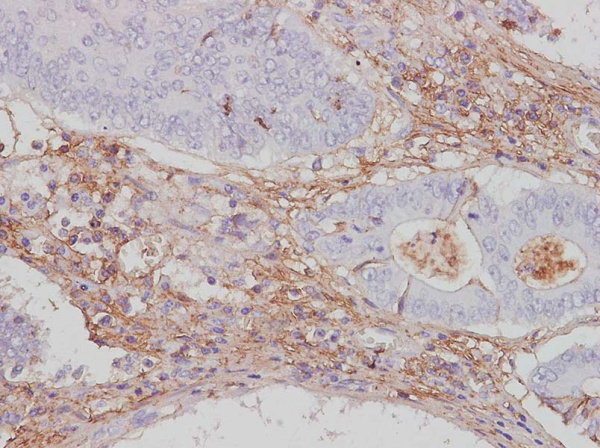 CTLA4 Polyclonal Antibody (AN006100L)