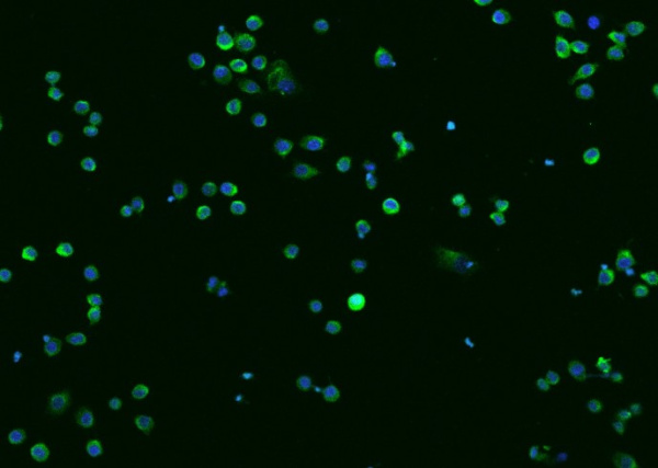 Recombinant CTSZ/CTSX/Cathepsin Z Monoclonal Antibody (AN300474P)