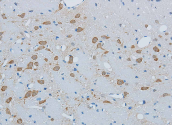 TIMP4 Polyclonal Antibody (E-AB-40161)