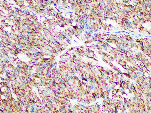 Calcitonin Monoclonal Antibody (ELAB6920-M)