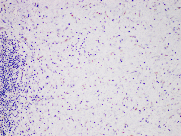 MDM2 Monoclonal Antibody (ELAB6847-R)