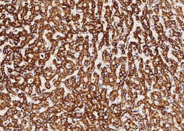 Recombinant COX5B Monoclonal Antibody (AN300095P)