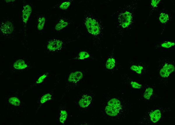 Recombinant MSH6/GTBP Monoclonal Antibody (AN300129P)