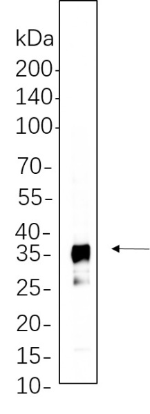 Recombinant IκB-α Monoclonal Antibody (AN300686L)