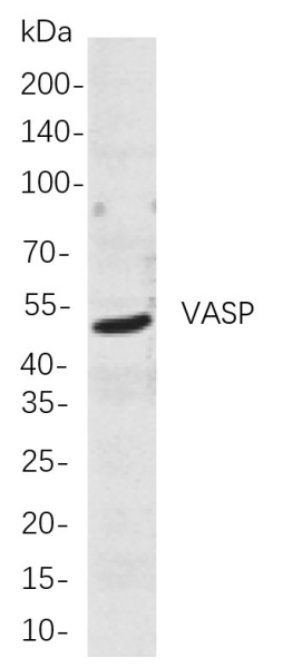 Recombinant VASP Monoclonal Antibody (AN300985L)