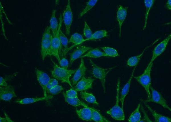 Recombinant CD44 Monoclonal Antibody (AN300039P)
