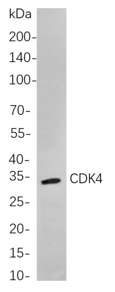Recombinant CDK4 Monoclonal Antibody (AN300936L)