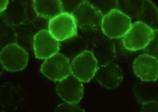 Recombinant CD6/Cluster of Differentiation 6 Monoclonal Antibody (AN300549P)