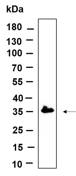 Recombinant C7orf42 Monoclonal Antibody (AN301194L)