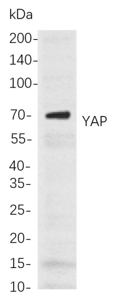 Recombinant YAP Monoclonal Antibody (AN300855L)