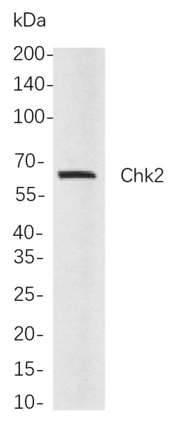 Recombinant Chk2 Monoclonal Antibody (AN300955L)