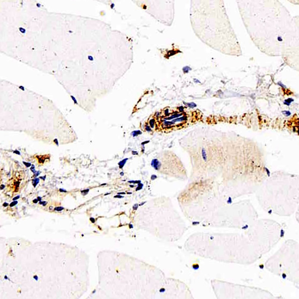 DLL4 Polyclonal Antibody (E-AB-70190)