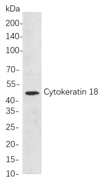 Recombinant Cytokeratin 18 Monoclonal Antibody (AN300958L)