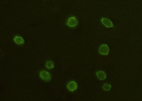 Recombinant CD97 Monoclonal Antibody (AN300397P)
