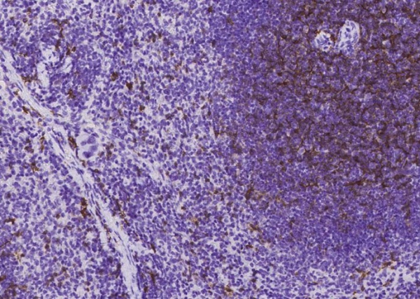 Recombinant CD8 alpha/CD8A Monoclonal Antibody (AN300513P)