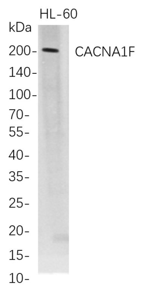 Recombinant CACNA1F Monoclonal Antibody (AN300743L)