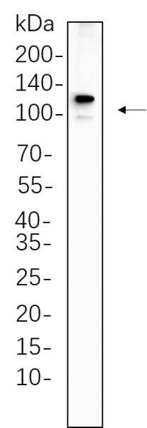 Recombinant PMS2 Monoclonal Antibody (AN301379L)
