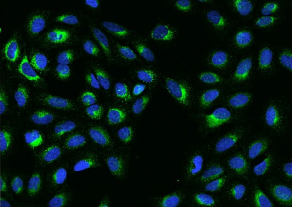 Recombinant S100B Monoclonal Antibody (AN300068P)