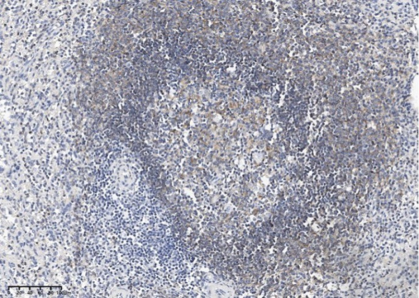 CD19 Monoclonal Antibody (AN200114P)