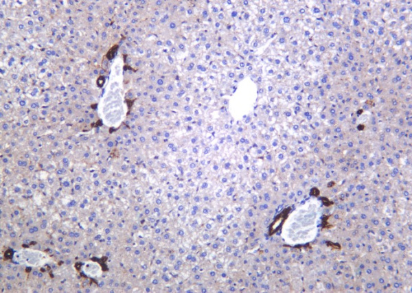 Recombinant LDLR Monoclonal Antibody (AN301402L)
