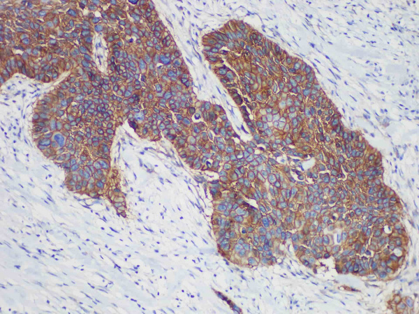 EGFR Monoclonal Antibody (ELAB6925-R)