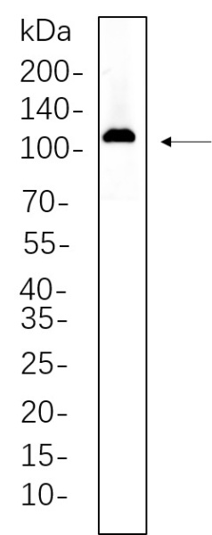 Recombinant Actinin-α2 Monoclonal Antibody (AN300596L)