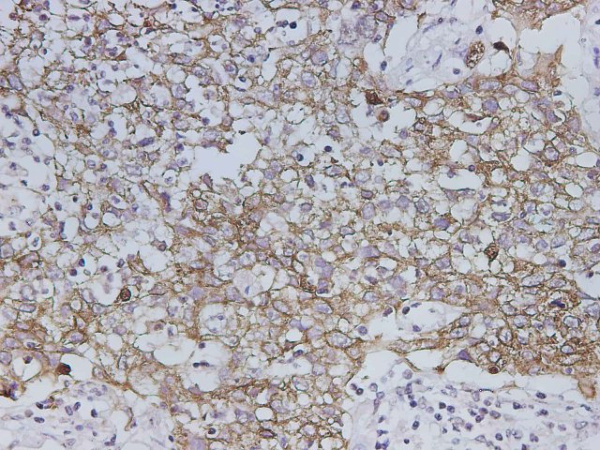 CK19 Polyclonal Antibody (D-AB-10360L)