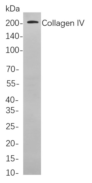 Recombinant Collagen IV Monoclonal Antibody (AN301106L)