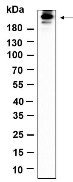 Recombinant Phospho-Acetyl-CoA Carboxylase (Ser79) Monoclonal Antibody (AN301391L)