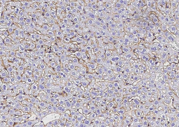 Recombinant SerpinF2/SERPINF2 Monoclonal Antibody (AN300485P)