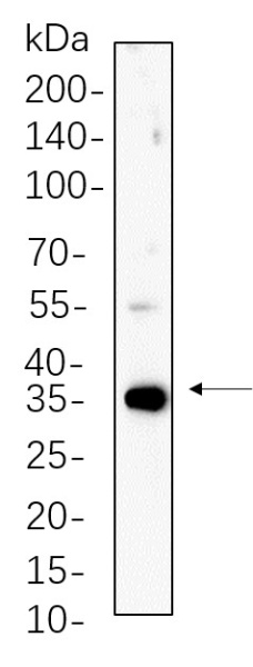 Recombinant PP1α/β Monoclonal Antibody (AN300665L)