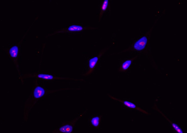Recombinant ABHD14B Monoclonal Antibody (AN300446P)